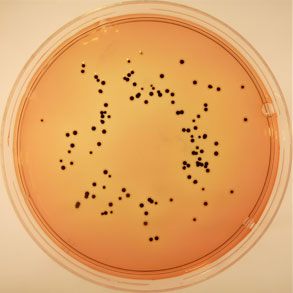 D.C.A. HYNES (Desoxycholate Citrate Agar) LEIFSON