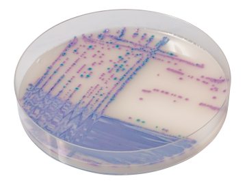 CHROMagar™ Salmonella PLUS jauhe ja lisäaine